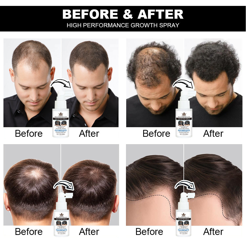 Hair Growth Spray 60ml